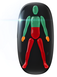 Movement highly affected in the mid-trunk and legs, with coordination and grip moderately affected in the hands.