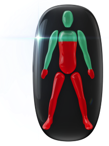 Movement and coordination affected to a high degree from the chest down and in the legs and also in the hands.