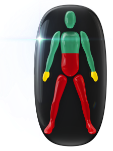 Movement highly affected in the mid-trunk and legs and mildly affected in the hands.