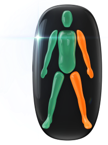 Movement moderately affected in one arm and one leg on the same side.