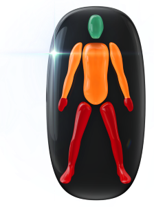 Movement and coordination moderately affected in the trunk and arms and highly affected in the hands and legs.
